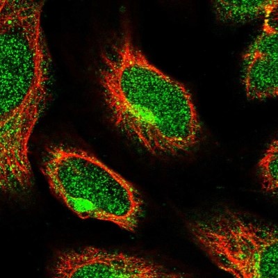 Immunocytochemistry/Immunofluorescence: HPSE2 Antibody [NBP1-93691] - Staining of human cell line U-2 OS shows positivity in nucleus but not nucleoli and cytoplasm.