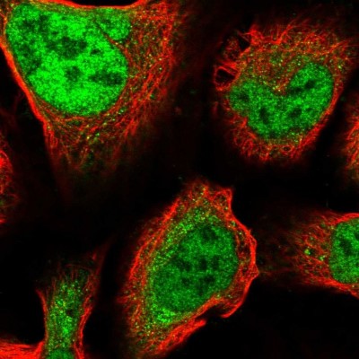 Immunocytochemistry/Immunofluorescence: ZNF281 Antibody [NBP2-13564] - Immunofluorescent staining of human cell line U-2 OS shows localization to nucleoplasm.