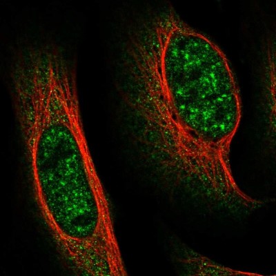 Immunocytochemistry/Immunofluorescence: FAM160B1 Antibody [NBP1-88970] - Immunofluorescent staining of human cell line U-2 OS shows localization to nuclear speckles & cytosol.