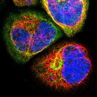 Immunocytochemistry/Immunofluorescence: WDR89 Antibody [NBP1-88413] - Staining of human cell line A-431 shows positivity in cytoplasm and cytoskeleton (intermediate filaments).