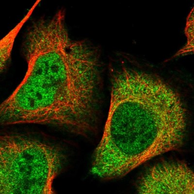 Immunocytochemistry/Immunofluorescence: DDI2 Antibody [NBP2-47493] - Immunofluorescent staining of human cell line U-2 OS shows localization to nucleoplasm & cytosol.