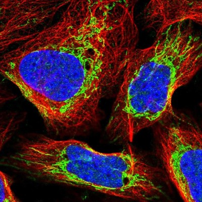 Immunocytochemistry/Immunofluorescence: Exosome component 8 Antibody [NBP2-47466] - Immunofluorescent staining of human cell line U-2 OS shows localization to nucleoplasm & mitochondria.