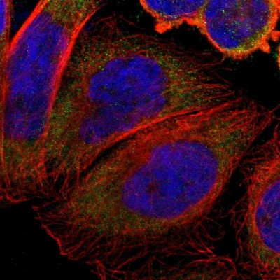 Immunocytochemistry/Immunofluorescence: Stomatin Antibody [NBP1-88561] - Immunofluorescent staining of human cell line A-431 shows localization to cytosol.