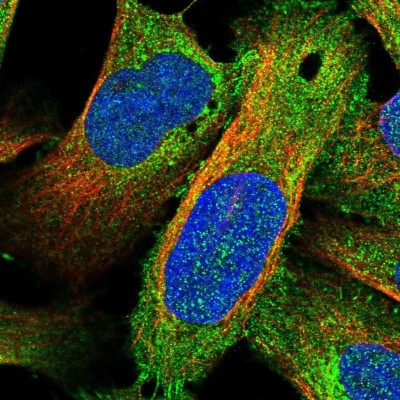 Immunocytochemistry/Immunofluorescence: SHCBP1L Antibody [NBP1-90716] - Staining of human cell line U-2 OS shows positivity in plasma membrane, cytoplasm and cell junctions.
