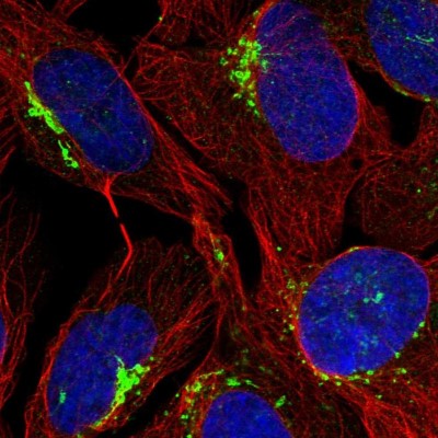 Immunocytochemistry/Immunofluorescence: FAM207A Antibody [NBP1-90676] - Immunofluorescent staining of human cell line U-2 OS shows localization to the Golgi apparatus & vesicles.