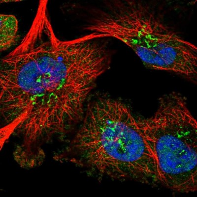 Immunocytochemistry/Immunofluorescence: RPUSD1 Antibody [NBP1-88448] - Immunofluorescent staining of human cell line U-251 MG shows localization to nucleus, cytosol & the Golgi apparatus.