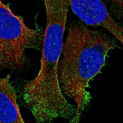 Immunocytochemistry/Immunofluorescence: DHRS9 Antibody [NBP1-89379] - Staining of human cell line U-2 OS shows positivity in plasma membrane and cytoplasm.