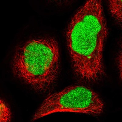 Immunocytochemistry/Immunofluorescence: REPIN1 Antibody [NBP1-89059] - Immunofluorescent staining of human cell line A-431 shows localization to nucleus.