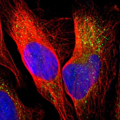 Immunocytochemistry/Immunofluorescence: PANK2 Antibody [NBP1-88295] - Immunofluorescent staining of human cell line U-2 OS shows localization to cytosol.