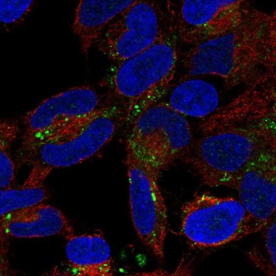 Immunocytochemistry/Immunofluorescence: IRAK1BP1 Antibody [NBP1-89178] - Staining of human cell line SH-SY5Y shows localization to vesicles.