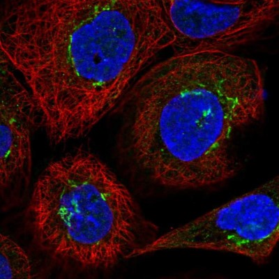 Immunocytochemistry/Immunofluorescence: VDP p115 Antibody [NBP2-38401] - Immunofluorescent staining of human cell line A-431 shows localization to the Golgi apparatus.