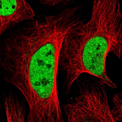 Immunocytochemistry/Immunofluorescence: SETD5 Antibody [NBP2-38257] - Immunofluorescent staining of human cell line U-2 OS shows localization to nucleoplasm.