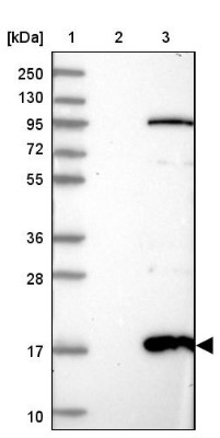 Western Blot: C11orf67 Antibody [NBP2-34040] - Lane 1: Marker [kDa] 250, 130, 95, 72, 55, 36, 28, 17, 10Lane 2: Negative control (vector only transfected HEK293T lysate)Lane 3: Over-expression lysate (Co-expressed with a C-terminal myc-DDK tag (~3.1 kDa) in mammalian HEK293T cells, LY411144)