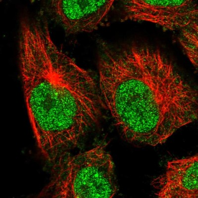 Immunocytochemistry/Immunofluorescence: C11orf67 Antibody [NBP2-34040] - Immunofluorescent staining of human cell line U-251 MG shows localization to nucleoplasm.