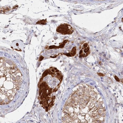 Immunohistochemistry: C11orf67 Antibody [NBP2-34040] - Staining of human testis shows distinct cytoplasmic positivity in Leydig cells.