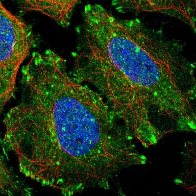Immunocytochemistry/Immunofluorescence: Testin Antibody [NBP1-85072] - Immunofluorescent staining of human cell line SiHa shows localization to plasma membrane, cytosol & focal adhesion sites.