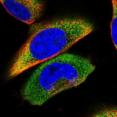 Immunocytochemistry/Immunofluorescence: Stomatin-like protein 1 Antibody [NBP1-92455] - Immunofluorescent staining of human cell line U-251 MG shows localization to cytosol.