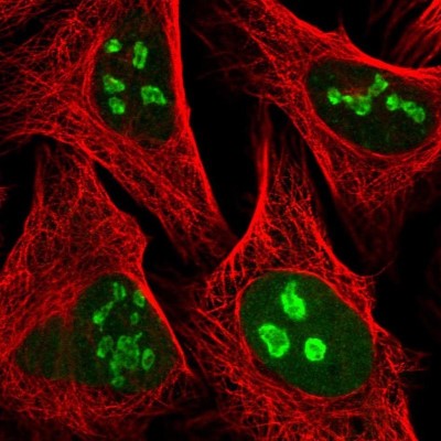 Immunocytochemistry/Immunofluorescence: PAPSS1 Antibody [NBP2-13730] - Staining of human cell line U-2 OS shows localization to nucleus & nucleoli.