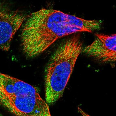 Immunocytochemistry/Immunofluorescence: DCP1B Antibody [NBP1-82018] - Immunofluorescent staining of human cell line U-251 MG shows localization to cytosol.