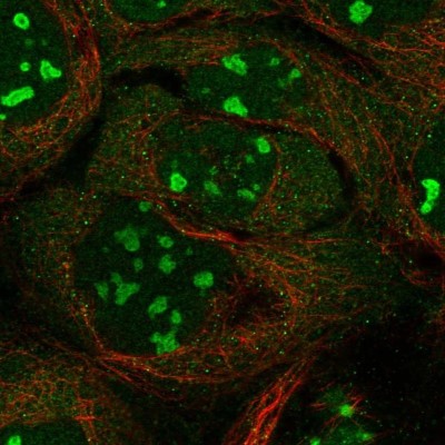 Immunocytochemistry/Immunofluorescence: INT4 Antibody [NBP1-83102] - Staining of human cell line A-431 shows localization to nucleoli.