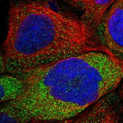 Immunocytochemistry/Immunofluorescence: LRSAM1 Antibody [NBP1-82016] - Immunofluorescent staining of human cell line A-431 shows localization to cytosol.