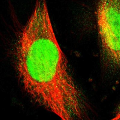 Immunocytochemistry/Immunofluorescence: WDR4 Antibody [NBP1-86901] - Immunofluorescent staining of human cell line U-251 MG shows localization to nucleoplasm & cytosol.