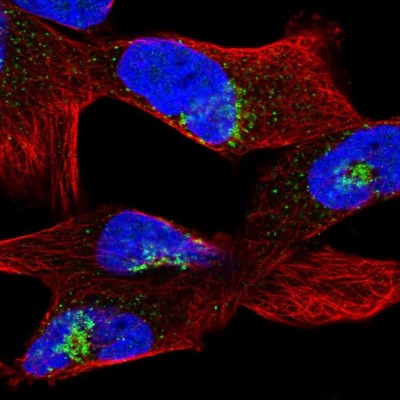 Immunocytochemistry/Immunofluorescence: PC6 Antibody [NBP1-87326] - Immunofluorescent staining of human cell line RH-30 shows localization to the Golgi apparatus.