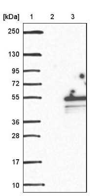 Western Blot: C1orf177 Antibody [NBP1-83457] - Lane 1: Marker [kDa] 250, 130, 95, 72, 55, 36, 28, 17, 10. Lane 2: Negative control (vector only transfected HEK293T lysate). Lane 3: Over-expression lysate (Co-expressed with a C-terminal myc-DDK tag (3.1 kDa) in mammalian HEK293T cells).