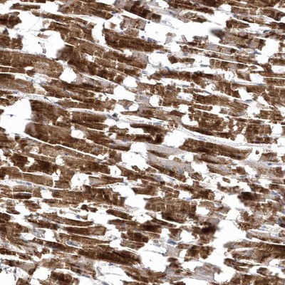 Immunohistochemistry-Paraffin: C1orf177 Antibody [NBP1-83457] - Staining of human heart muscle shows strong cytoplasmic positivity in myocytes.