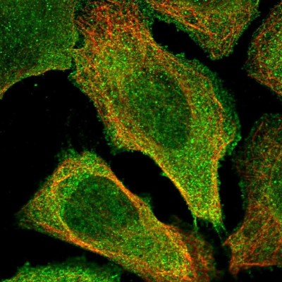Immunocytochemistry/Immunofluorescence: CCDC76 Antibody [NBP1-84643] - Staining of human cell line U-2 OS shows positivity in nucleus but not nucleoli and plasma membrane.