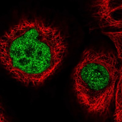 Immunocytochemistry/Immunofluorescence: ST7/LRP12 Antibody [NBP1-84771] - Immunofluorescent staining of human cell line A-431 shows localization to nucleoplasm.