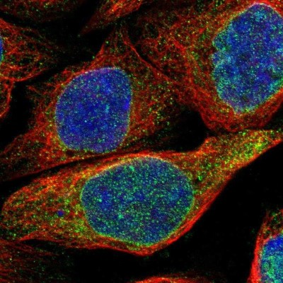 Immunocytochemistry/Immunofluorescence: MCM3AP Antibody [NBP1-83393] - Staining of human cell line A-431 shows positivity in nuclear membrane and cytoplasm.