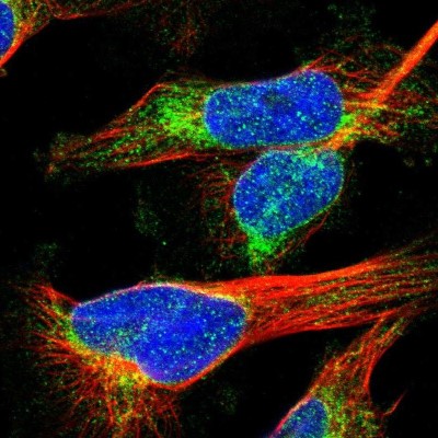 Immunocytochemistry/Immunofluorescence: MCM3AP Antibody [NBP1-83393] - Immunofluorescent staining of human cell line U-251 MG shows localization to nuclear membrane & cytosol.