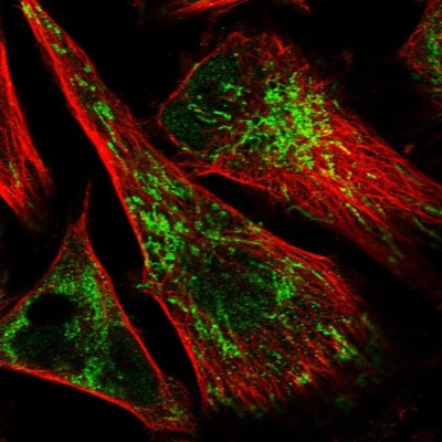 Immunocytochemistry/Immunofluorescence: IMPA1 Antibody [NBP1-83107] - Immunofluorescent staining of human cell line U-251 MG shows localization to nucleoplasm & mitochondria.