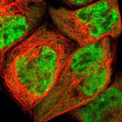 Immunocytochemistry/Immunofluorescence: TAF7 Antibody [NBP1-80704] - Immunofluorescent staining of human cell line A-431 shows localization to nucleoplasm.