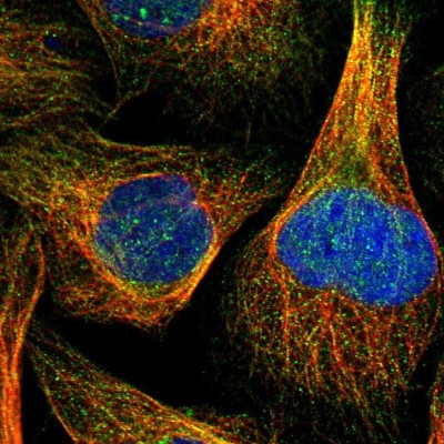 Immunocytochemistry/Immunofluorescence: RNF141 Antibody [NBP1-80603] - Immunofluorescent staining of human cell line U-2 OS shows localization to nucleoplasm & microtubules.