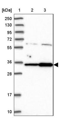 Western Blot: C3orf26 Antibody [NBP1-81078] - Lane 1: Marker  [kDa] 250, 130, 95, 72, 55, 36, 28, 17, 10.  Lane 2: Human cell line RT-4.  Lane 3: Human cell line U-251MG sp