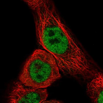 Immunocytochemistry/Immunofluorescence: CCDC97 Antibody [NBP1-91768] - Immunofluorescent staining of human cell line A-431 shows localization to nucleoplasm.