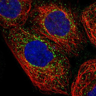Immunocytochemistry/Immunofluorescence: NME6 Antibody [NBP1-81587] - Immunofluorescent staining of human cell line A-431 shows localization to vesicles.