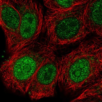 Immunocytochemistry/Immunofluorescence: SFRS9 Antibody [NBP2-13385] - Immunofluorescent staining of human cell line MCF7 shows localization to nucleoplasm & nucleoli.