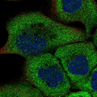 Immunocytochemistry/Immunofluorescence: RUSC1 Antibody [NBP1-81004] - Staining of human cell line A-431 shows positivity in cytoplasm.