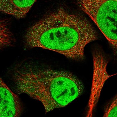 Immunocytochemistry/Immunofluorescence: SERTAD2 Antibody [NBP1-81541] - Staining of human cell line U-2 OS shows positivity in nucleus but not nucleoli and cytoplasm.