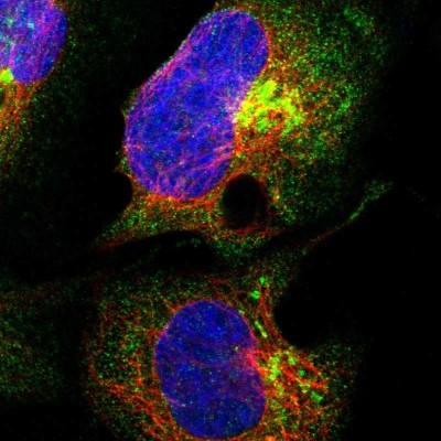 Immunocytochemistry/Immunofluorescence: ANKRD40 Antibody [NBP1-93515] - Immunofluorescent staining of human cell line U-2 OS shows localization to cytosol & the Golgi apparatus.