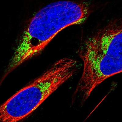 Immunocytochemistry/Immunofluorescence: ZFP200 Antibody [NBP1-87460] - Immunofluorescent staining of human cell line U-2 OS shows localization to mitochondria.