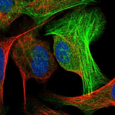 Immunocytochemistry/Immunofluorescence: ALG2 Antibody [NBP1-85715] - Staining of human cell line U-2 OS shows localization to cytosol & actin filaments.