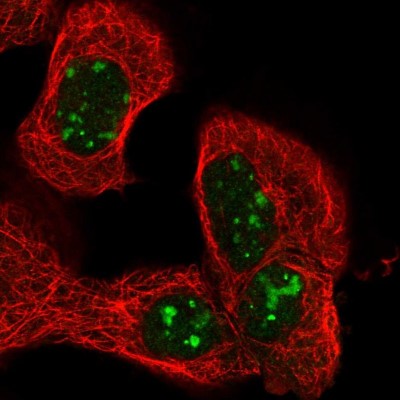 Immunocytochemistry/Immunofluorescence: NSMAF Antibody [NBP1-84735] - Immunofluorescent staining of human cell line A-431 shows localization to nucleoli.