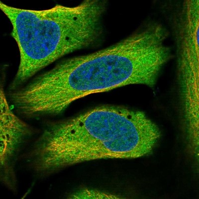 Immunocytochemistry/Immunofluorescence: PIGX Antibody [NBP1-83647] - Immunofluorescent staining of human cell line U-2 OS shows localization to nucleoplasm & cytosol.