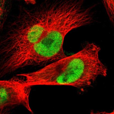 Immunocytochemistry/Immunofluorescence: JPH1 Antibody [NBP1-83076] - Immunofluorescent staining of human cell line U-251 MG shows localization to nucleoplasm.