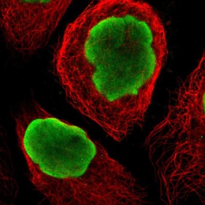 Immunocytochemistry/Immunofluorescence: C1orf187 Antibody [NBP1-83505] - Staining of human cell line A-431 shows positivity in nucleus but not nucleoli.