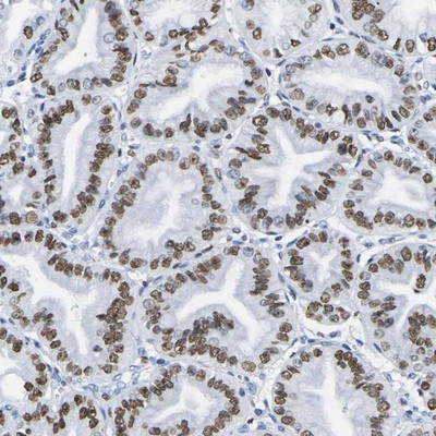 Immunohistochemistry-Paraffin: C1orf187 Antibody [NBP1-83505] - Staining of human stomach shows strong nuclear positivity in glandular cells.